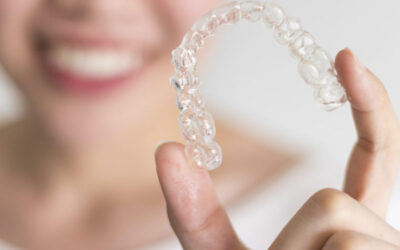 Alineadores invisibles: todo lo que necesitas saber