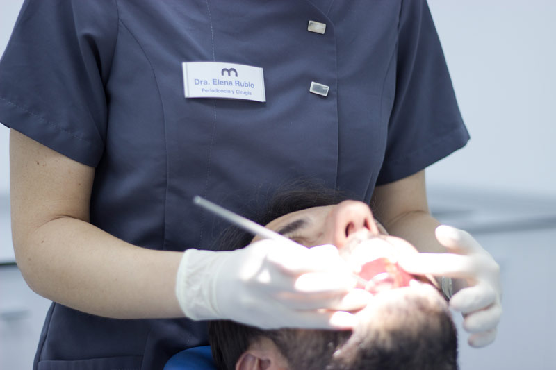 Revisión dental - Clínica dental Bugella&Rubio