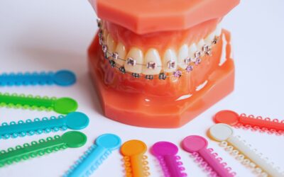 Cómo cuidar tus dientes cuando tienes ortodoncia
