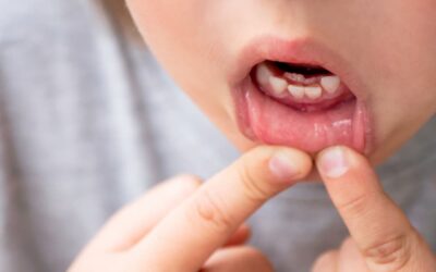 Dientes de leche: claves para el desarrollo infantil