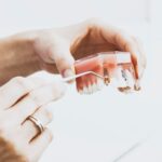 ¿Puedo llevar ortodoncia si tengo implantes?