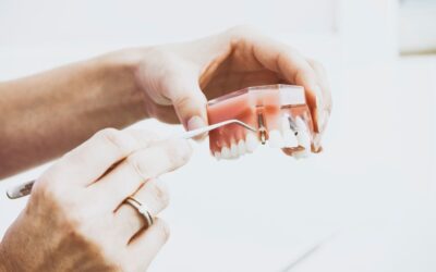 ¿Puedo llevar ortodoncia si tengo implantes?