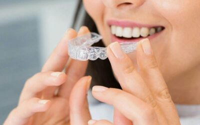 ¿Qué son los retenedores dentales y por qué son imprescindibles después de la ortodoncia?